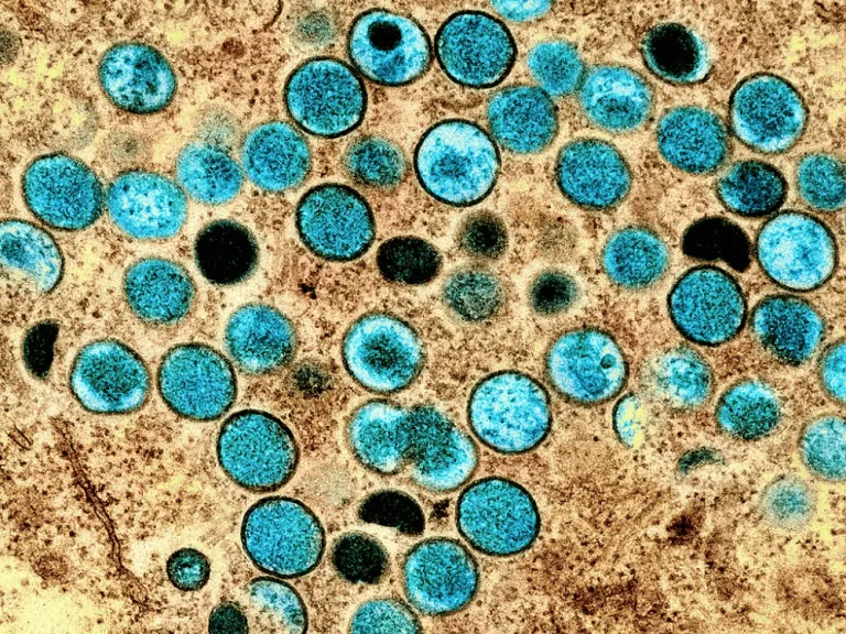 Monkey Pox Virus 
